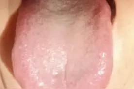 肝郁到了一定程度，就不要用柴胡舒肝散，调理效果已经不好了！图片