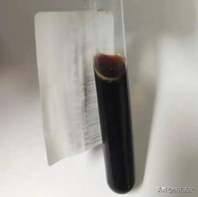 健身猛如虎，尿出酱油色！医生警告：这事别硬扛