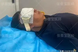 最省钱的去除“眼袋泪沟”的方法在这，医生亲自整理图片