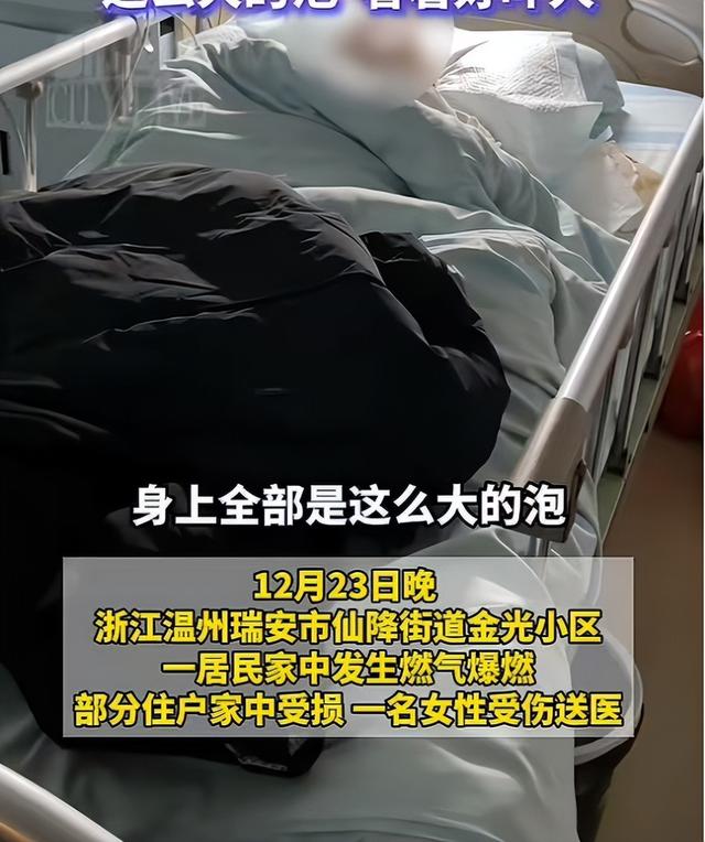 就差这10分钟！温州一出租屋突然爆炸，女子全身烧伤，丈夫因去买苹果躲过一劫