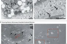 100% 发现，顶刊首次证实微塑料对人有害！这种情况死亡风险升高 3.5 倍图片