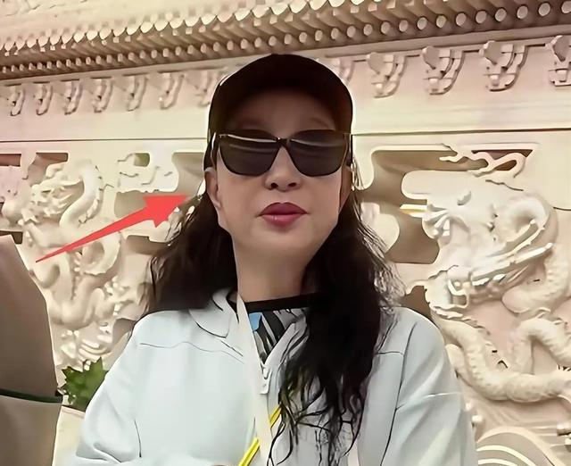 钱再多有什么用75岁刘晓庆摔断左臂,拒绝休养只因无儿无女