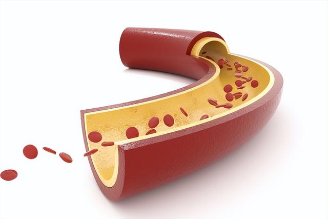 55岁女子突发脑梗去世，生前爱运动不熬夜	，丈夫哭诉：她不听我的