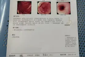 人生第一次肠胃镜经历图片