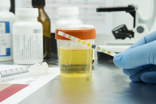 肾病恶化前不是水肿！医生：频繁出现3个不适，是肾脏在求救