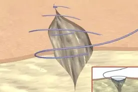 外科缝合技巧图片