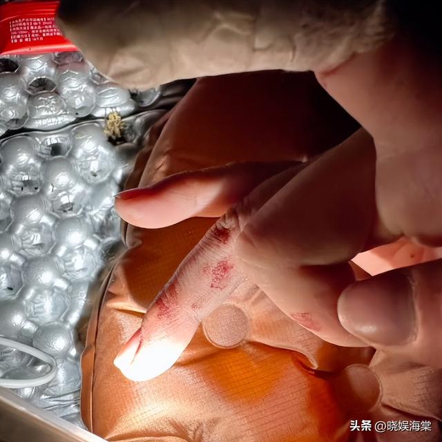 登山网暴救命搭子后续：为救人手废了，女子身份被扒，全程作死