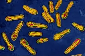 世界十大生化武器，你听过的绝不会超过3种！埃博拉病毒只排第九图片