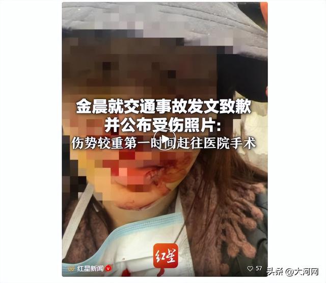金晨发车祸现场图，满脸是血；知情人：相关讨论登上热搜后	，金晨曾抵绍兴