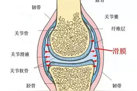 一分钟带你了解滑膜炎！图片