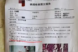 二次病理再出结果，竟然又不一样？小周一下子无语了！到底谁的错图片
