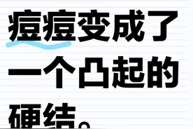 痘痘变硬块了，怎么解决图片