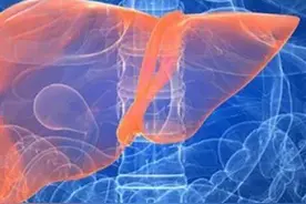 你的尿黄吗？尿黄的原因及应对措施图片