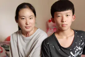 2019年，河南16岁少女火海救弟弟被毁容，弟弟：没人要你，我娶你图片