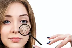 湿疹反复发作，抓挠之后更痒！用这几招管用，掐断湿疹病根图片
