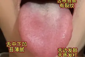 今日三大典型案例——欲望强烈，力不从心，口干口苦，湿气较重！图片