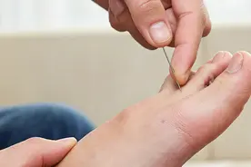 扎脚趾和掐人中，真的能救命吗？图片