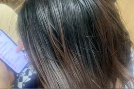 网上卖的防脱发的洗发水有用吗？图片