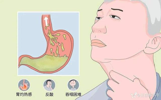 午睡半小时错了？医生告诫：上了60岁后，午睡请注意5点