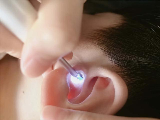 西圣Find X智能可视耳勺评测：UV杀菌安全舒适，耳道清洁新标杆！