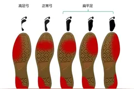 咦？你的鞋底会说话！鞋底的不同磨损，到底暗示着什么？图片