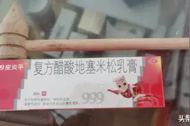 我一到夏天腿上就起红疙瘩 很痒图片