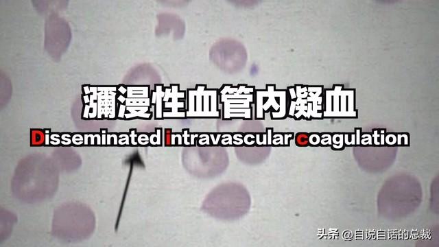 花胶块胶 “花胶”