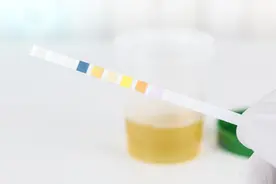 憋尿太久尿不出来怎么办？为什么很尿急却只尿出来几滴尿？图片
