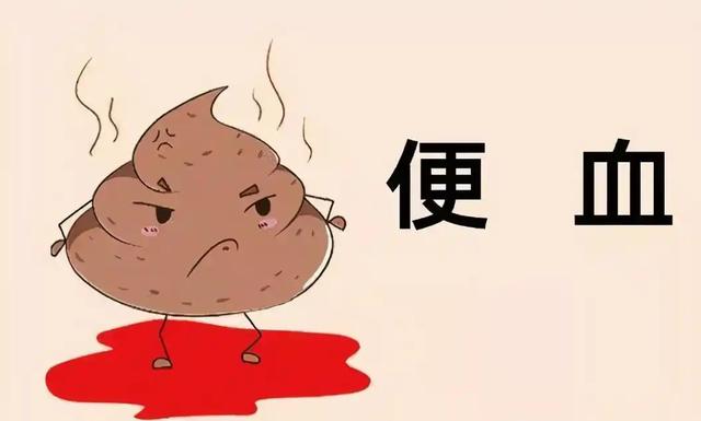 大便是结肠癌最好的“预警”!提示:出现这3个异常,多半是肠癌