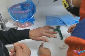 手术被戒指“难倒” 消防“钳”来帮忙图片