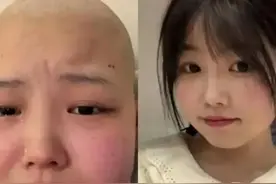 太惨！女孩高考时晕倒确诊骨癌摆摊赚钱，为活命截肢，父母不管她图片