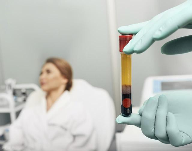 眉间有竖纹好烦？科学去除有妙招，让你告别“愁眉苦脸”