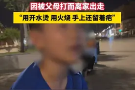 用开水烫、用火烧！九岁男孩用最平静的语气描述着家暴自己的父母图片
