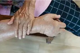 不管多大年纪，双手若有4个异常，多半是疾病缠身了，尽快去检查图片