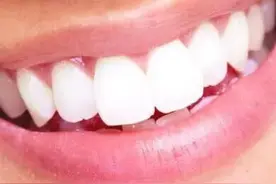 关于宝妈哺乳期看牙的讨论图片