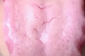 舌头既有齿痕，又有裂纹？中医送你三味药，健脾利湿，滋补胃阴！图片