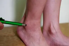 腰椎间盘突出，腿麻脚麻恢复缓慢，现在告诉你怎么干预比较好图片