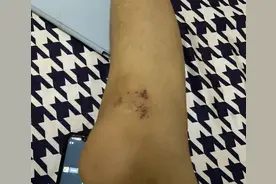 “特训学校”逼学生吃泔水馒头🤮网友：别再送孩子去了……图片