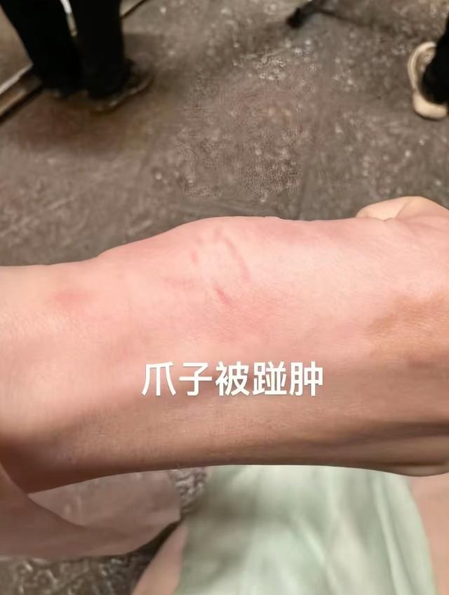 短剧女演员被男主一脚踹飞，指甲当场断裂，贾玲的话又一次应验了