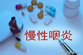 长期喉咙干痒、异物感有痰？这5个药收藏好图片