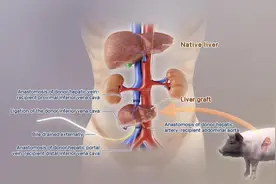 全球首例！中国团队成功将基因编辑猪肝脏移植人体图片