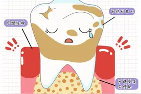 牙龈炎、牙周炎、牙髓炎只有一字之差，区别竟然这么大！图片