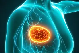 乳腺癌：全国各地放疗大致收费情况介绍图片