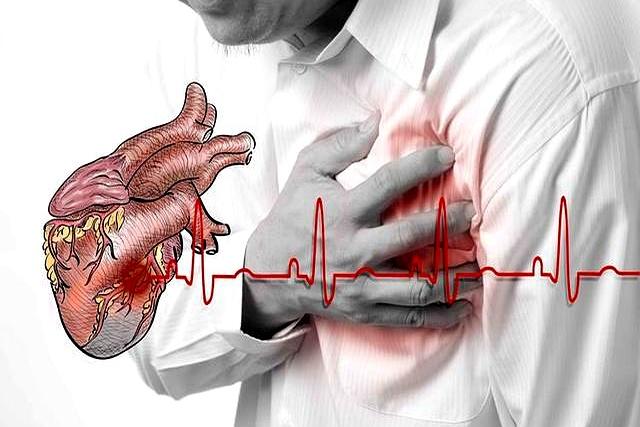 血压高的人	，不能跑步？医生警告：不止跑步，这些事也尽量避免！