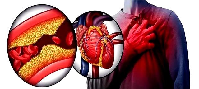 70岁后，还适合走路运动吗？医生说出答案，可能和你想的不同