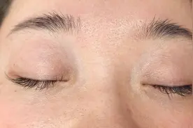 杭州医院里的中式“热拉提”火了！杭州网记者亲身体验，法令纹和黑眼圈有改善图片