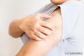 皮肤上长出这3种小红点，虽然不痛不痒，或是疾病的信号图片