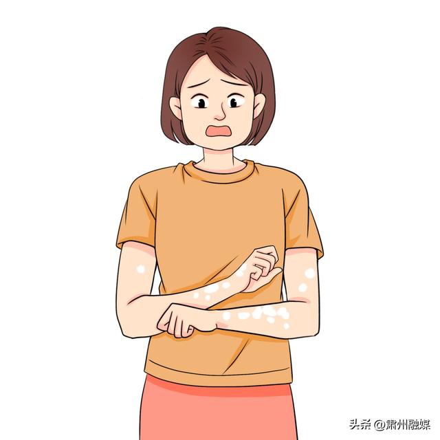 一脱衣服身上很多皮屑脱落，怎么回事？是缺维生素了？涨知识了！
