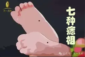 “千金难买脚底痣”，脚的7种痣相，你是哪个？最后独压万人心图片