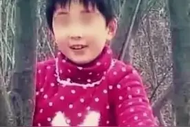 "猪皮移植，人命关天：揭秘8岁女孩的奇迹康复之路！"图片